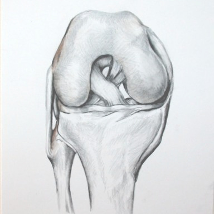 Knee Surgery